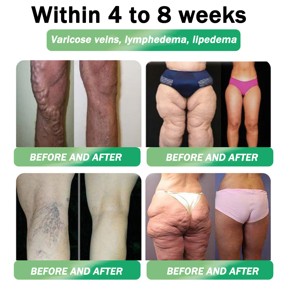 🇺🇸𝑶𝒇𝒇𝒊𝒄𝒊𝒂𝒍 𝑺𝒕𝒐𝒓𝒆|HH𝐕𝐁® 𝐍𝐀𝐃+ 𝐆𝐋𝐏-𝟏 Pro ALL-IN-ONE Fit&Vital 𝐎𝐫𝐚𝐥 𝐋𝐢𝐪𝐮𝐢𝐝 (𝐉𝐮𝐬𝐭 𝐨𝐧𝐜𝐞 𝐚 𝐝𝐚𝐲, 𝐯𝐢𝐬𝐢𝐛𝐥𝐞 𝐜𝐡𝐚𝐧𝐠𝐞𝐬 𝐢𝐧 𝟕 𝐝𝐚𝐲𝐬） ✅ 𝐅𝐨𝐫 𝐨𝐛𝐞𝐬𝐢𝐭𝐲, 𝐜𝐚𝐫𝐝𝐢𝐨𝐯𝐚𝐬𝐜𝐮𝐥𝐚𝐫 𝐡𝐞𝐚𝐥𝐭𝐡, 𝐝𝐢𝐚𝐛𝐞𝐭𝐞𝐬, 𝐬𝐥𝐞𝐞𝐩 𝐚𝐩𝐧𝐞𝐚, 𝐆𝐮𝐭 𝐇𝐞𝐚𝐥𝐭𝐡, 𝐣𝐨𝐢𝐧𝐭 𝐢𝐬𝐬𝐮𝐞𝐬, 𝐚𝐧𝐝 𝐦𝐨𝐫𝐞