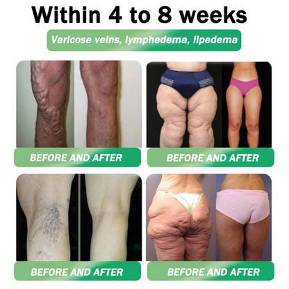 🇺🇸𝑶𝒇𝒇𝒊𝒄𝒊𝒂𝒍 𝑺𝒕𝒐𝒓𝒆|HH𝐕𝐁® 𝐍𝐀𝐃+ 𝐆𝐋𝐏-𝟏 Pro ALL-IN-ONE Fit&Vital 𝐎𝐫𝐚𝐥 𝐋𝐢𝐪𝐮𝐢𝐝 (𝐉𝐮𝐬𝐭 𝐨𝐧𝐜𝐞 𝐚 𝐝𝐚𝐲, 𝐯𝐢𝐬𝐢𝐛𝐥𝐞 𝐜𝐡𝐚𝐧𝐠𝐞𝐬 𝐢𝐧 𝟕 𝐝𝐚𝐲𝐬） ✅ 𝐅𝐨𝐫 𝐨𝐛𝐞𝐬𝐢𝐭𝐲, 𝐜𝐚𝐫𝐝𝐢𝐨𝐯𝐚𝐬𝐜𝐮𝐥𝐚𝐫 𝐡𝐞𝐚𝐥𝐭𝐡, 𝐝𝐢𝐚𝐛𝐞𝐭𝐞𝐬, 𝐬𝐥𝐞𝐞𝐩 𝐚𝐩𝐧𝐞𝐚, 𝐆𝐮𝐭 𝐇𝐞𝐚𝐥𝐭𝐡, 𝐣𝐨𝐢𝐧𝐭 𝐢𝐬𝐬𝐮𝐞𝐬, 𝐚𝐧𝐝 𝐦𝐨𝐫𝐞