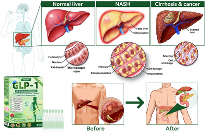 🇺🇸𝑶𝒇𝒇𝒊𝒄𝒊𝒂𝒍 𝑺𝒕𝒐𝒓𝒆|HH𝐕𝐁® 𝐍𝐀𝐃+ 𝐆𝐋𝐏-𝟏 Pro ALL-IN-ONE Fit&Vital 𝐎𝐫𝐚𝐥 𝐋𝐢𝐪𝐮𝐢𝐝 (𝐉𝐮𝐬𝐭 𝐨𝐧𝐜𝐞 𝐚 𝐝𝐚𝐲, 𝐯𝐢𝐬𝐢𝐛𝐥𝐞 𝐜𝐡𝐚𝐧𝐠𝐞𝐬 𝐢𝐧 𝟕 𝐝𝐚𝐲𝐬） ✅ 𝐅𝐨𝐫 𝐨𝐛𝐞𝐬𝐢𝐭𝐲, 𝐜𝐚𝐫𝐝𝐢𝐨𝐯𝐚𝐬𝐜𝐮𝐥𝐚𝐫 𝐡𝐞𝐚𝐥𝐭𝐡, 𝐝𝐢𝐚𝐛𝐞𝐭𝐞𝐬, 𝐬𝐥𝐞𝐞𝐩 𝐚𝐩𝐧𝐞𝐚, 𝐆𝐮𝐭 𝐇𝐞𝐚𝐥𝐭𝐡, 𝐣𝐨𝐢𝐧𝐭 𝐢𝐬𝐬𝐮𝐞𝐬, 𝐚𝐧𝐝 𝐦𝐨𝐫𝐞