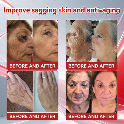 🇺🇸𝑶𝒇𝒇𝒊𝒄𝒊𝒂𝒍 𝑺𝒕𝒐𝒓𝒆𝑰𝐻𝐻𝑉𝐵®🌿𝑮𝑳𝑷-1+𝑪𝒐𝒍𝒍𝒂𝒈𝒆𝒏 𝑷𝒆𝒑𝒕𝒊𝒅𝒆𝒔 𝑾𝒆𝒊𝒈𝒉𝒕 𝑳𝒐𝒔𝒔&𝑭𝒊𝒓𝒎𝒊𝒏𝒈 𝑶𝒓𝒂𝒍 𝑺𝒐𝒍𝒖𝒕𝒊𝒐𝒏 𝒘𝒊𝒕𝒉 🔥𝑪𝒐𝒍𝒍𝒂𝒈𝒆𝒏 𝑷𝒆𝒑𝒕𝒊𝒅𝒆𝒔 & 𝑴𝒂𝒕𝒓𝒊𝒙𝒚𝒍 3000 𝒉𝒆𝒍𝒑𝒔 𝒕𝒂𝒓𝒈𝒆𝒕 ✅𝒐𝒃𝒆𝒔𝒊𝒕𝒚, 𝒇𝒊𝒓𝒎𝒔 𝒔𝒌𝒊𝒏,𝒄𝒂𝒓𝒅𝒊𝒐𝒗𝒂𝒔𝒄𝒖𝒍𝒂𝒓 𝒅𝒊𝒔𝒆𝒂𝒔𝒆, 𝒅𝒊𝒂𝒃𝒆𝒕𝒆𝒔, 𝒔𝒍𝒆𝒆𝒑 𝒂𝒑𝒏𝒆𝒂, 𝒋𝒐𝒊𝒏𝒕 𝒑𝒓𝒐𝒃𝒍𝒆𝒎𝒔, 𝒂𝒏𝒅 𝒎𝒐𝒓𝒆,