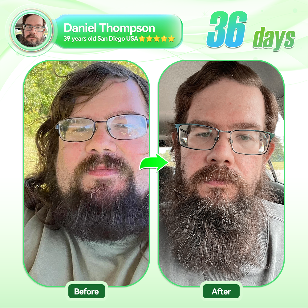 🇺🇸𝑶𝒇𝒇𝒊𝒄𝒊𝒂𝒍 𝑺𝒕𝒐𝒓𝒆|HH𝐕𝐁® 𝐍𝐀𝐃+ 𝐆𝐋𝐏-𝟏 Pro ALL-IN-ONE Fit&Vital 𝐎𝐫𝐚𝐥 𝐋𝐢𝐪𝐮𝐢𝐝 (𝐉𝐮𝐬𝐭 𝐨𝐧𝐜𝐞 𝐚 𝐝𝐚𝐲, 𝐯𝐢𝐬𝐢𝐛𝐥𝐞 𝐜𝐡𝐚𝐧𝐠𝐞𝐬 𝐢𝐧 𝟕 𝐝𝐚𝐲𝐬） ✅ 𝐅𝐨𝐫 𝐨𝐛𝐞𝐬𝐢𝐭𝐲, 𝐜𝐚𝐫𝐝𝐢𝐨𝐯𝐚𝐬𝐜𝐮𝐥𝐚𝐫 𝐡𝐞𝐚𝐥𝐭𝐡, 𝐝𝐢𝐚𝐛𝐞𝐭𝐞𝐬, 𝐬𝐥𝐞𝐞𝐩 𝐚𝐩𝐧𝐞𝐚, 𝐆𝐮𝐭 𝐇𝐞𝐚𝐥𝐭𝐡, 𝐣𝐨𝐢𝐧𝐭 𝐢𝐬𝐬𝐮𝐞𝐬, 𝐚𝐧𝐝 𝐦𝐨𝐫𝐞