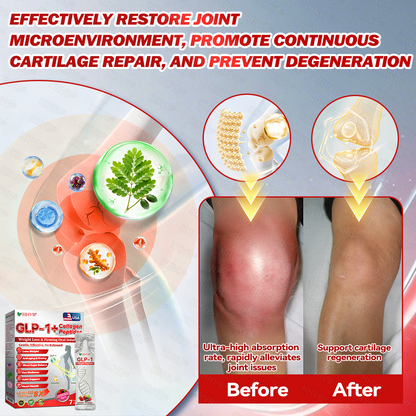 🇺🇸𝑶𝒇𝒇𝒊𝒄𝒊𝒂𝒍 𝑺𝒕𝒐𝒓𝒆𝑰𝐻𝐻𝑉𝐵®🌿𝑮𝑳𝑷-1+𝑪𝒐𝒍𝒍𝒂𝒈𝒆𝒏 𝑷𝒆𝒑𝒕𝒊𝒅𝒆𝒔 𝑾𝒆𝒊𝒈𝒉𝒕 𝑳𝒐𝒔𝒔&𝑭𝒊𝒓𝒎𝒊𝒏𝒈 𝑶𝒓𝒂𝒍 𝑺𝒐𝒍𝒖𝒕𝒊𝒐𝒏 𝒘𝒊𝒕𝒉 🔥𝑪𝒐𝒍𝒍𝒂𝒈𝒆𝒏 𝑷𝒆𝒑𝒕𝒊𝒅𝒆𝒔 & 𝑴𝒂𝒕𝒓𝒊𝒙𝒚𝒍 3000 𝒉𝒆𝒍𝒑𝒔 𝒕𝒂𝒓𝒈𝒆𝒕 ✅𝒐𝒃𝒆𝒔𝒊𝒕𝒚, 𝒇𝒊𝒓𝒎𝒔 𝒔𝒌𝒊𝒏,𝒄𝒂𝒓𝒅𝒊𝒐𝒗𝒂𝒔𝒄𝒖𝒍𝒂𝒓 𝒅𝒊𝒔𝒆𝒂𝒔𝒆, 𝒅𝒊𝒂𝒃𝒆𝒕𝒆𝒔, 𝒔𝒍𝒆𝒆𝒑 𝒂𝒑𝒏𝒆𝒂, 𝒋𝒐𝒊𝒏𝒕 𝒑𝒓𝒐𝒃𝒍𝒆𝒎𝒔, 𝒂𝒏𝒅 𝒎𝒐𝒓𝒆,