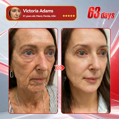 🇺🇸𝑶𝒇𝒇𝒊𝒄𝒊𝒂𝒍 𝑺𝒕𝒐𝒓𝒆𝑰𝐻𝐻𝑉𝐵®🌿𝑮𝑳𝑷-1+𝑪𝒐𝒍𝒍𝒂𝒈𝒆𝒏 𝑷𝒆𝒑𝒕𝒊𝒅𝒆𝒔 𝑾𝒆𝒊𝒈𝒉𝒕 𝑳𝒐𝒔𝒔&𝑭𝒊𝒓𝒎𝒊𝒏𝒈 𝑶𝒓𝒂𝒍 𝑺𝒐𝒍𝒖𝒕𝒊𝒐𝒏 𝒘𝒊𝒕𝒉 🔥𝑪𝒐𝒍𝒍𝒂𝒈𝒆𝒏 𝑷𝒆𝒑𝒕𝒊𝒅𝒆𝒔 & 𝑴𝒂𝒕𝒓𝒊𝒙𝒚𝒍 3000 𝒉𝒆𝒍𝒑𝒔 𝒕𝒂𝒓𝒈𝒆𝒕 ✅𝒐𝒃𝒆𝒔𝒊𝒕𝒚, 𝒇𝒊𝒓𝒎𝒔 𝒔𝒌𝒊𝒏,𝒄𝒂𝒓𝒅𝒊𝒐𝒗𝒂𝒔𝒄𝒖𝒍𝒂𝒓 𝒅𝒊𝒔𝒆𝒂𝒔𝒆, 𝒅𝒊𝒂𝒃𝒆𝒕𝒆𝒔, 𝒔𝒍𝒆𝒆𝒑 𝒂𝒑𝒏𝒆𝒂, 𝒋𝒐𝒊𝒏𝒕 𝒑𝒓𝒐𝒃𝒍𝒆𝒎𝒔, 𝒂𝒏𝒅 𝒎𝒐𝒓𝒆,